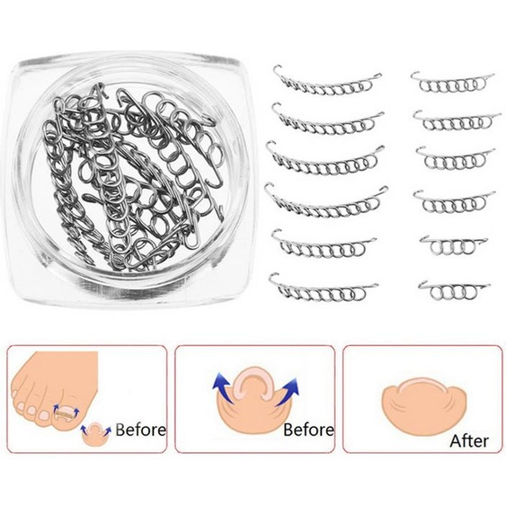 12 fils métalliques pour corriger les ongles incarnés, 6 tailles, soins des pieds, pédicure