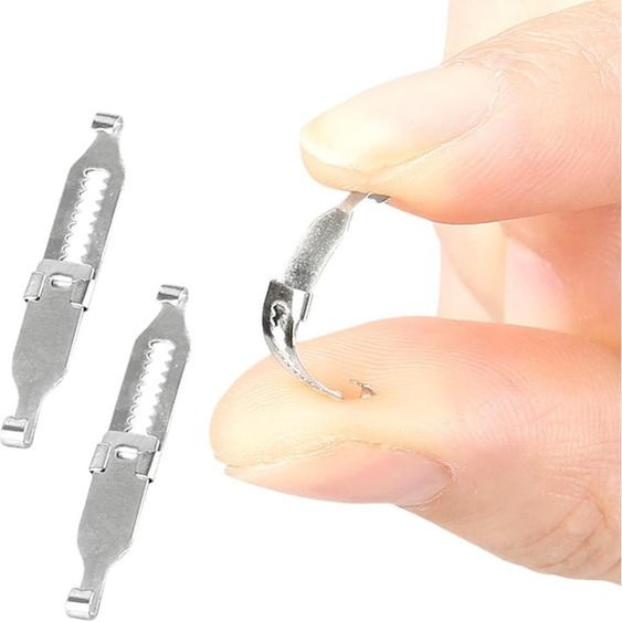 INF Clip Correcteur dOngles Incarnés Réglable - 2 Pcs Acier Inoxydable