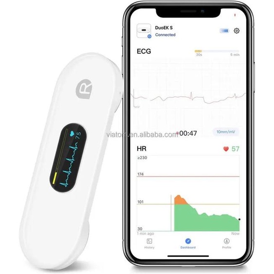 komwell Dispositif de surveillance ECG de poche avec écran OLED, moniteur ECG Bluetooth pour forme donde rythmique, analyse AI avec application gratuite avec iOS/Android
